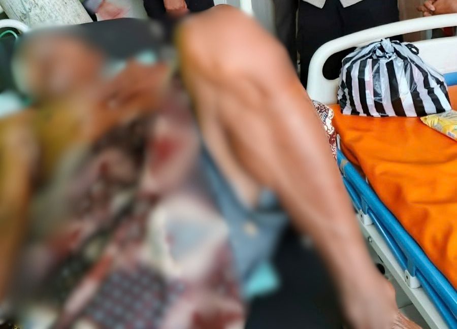 Kadiran mendapatkan penanganan medis di Puskesmas Ngadirojo setelah terperosok ke jurang saat memadamkan api di Pacitan.